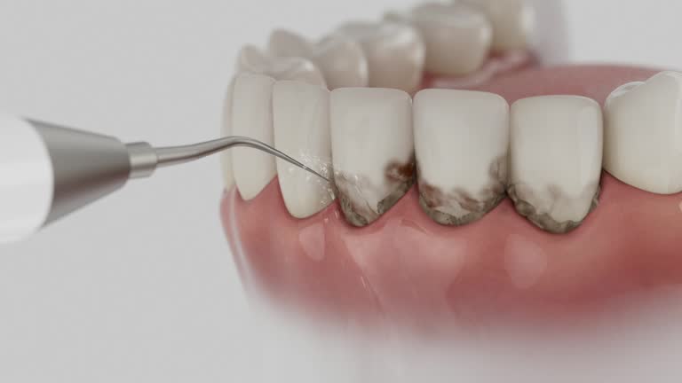 Reliable Dental Implants contractor in Hope Mills, NC by Smile Center Dentistry